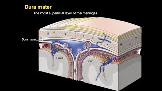 Intracranial Hypertension Patient QampA [upl. by Sneve]