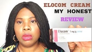 ELOCOM CREAM MY HONEST REVIEW skincare [upl. by Buffo606]