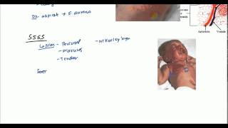 Staphylococcal Scalded Skin Syndrome SSSS and Bullous Impetigo [upl. by Macario]