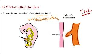 USMLE ACE Video 157 Common Gastrointestinal Disorders [upl. by Daile]