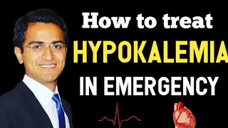 HYPOKALEMIA TREATMENT GUIDELINES SYMPTOMS MANAGEMENT ECG CHANGES POTTASSIUM REPLACEMENT PROTOCOL [upl. by Mook]