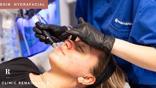 Hydrafacial  les différentes étapes du soin  Clinic Renaissance  médecine esthétique [upl. by Elma415]