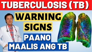 Tuberculosis TB Warnings Signs Paano Maalis ang TB  By Doc Willie Ong [upl. by Nema]