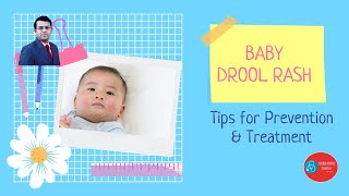 Drool Rash in babies  Tips on prevention and treatment [upl. by Naeruat]