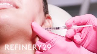 I Tried Jawline Contour amp Masseter Botox  Macro Beauty  Refinery29 [upl. by Eden]