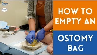 Emptying an Ostomy Bag [upl. by Nicks861]