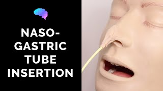 Nasogastric NG Tube Insertion  OSCE Guide  UKMLA  CPSA [upl. by Rina]