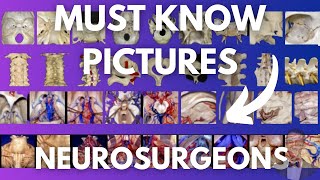 100 Anatomical Pictures You Must Know  Neurosurgeons Neuroradiologists amp Neuro Enthusiast  Part 1 [upl. by Elegna]