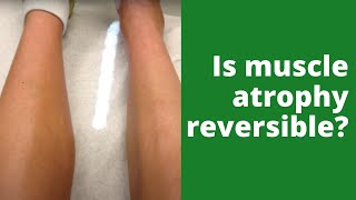 Is muscle atrophy reversible [upl. by Akfir]