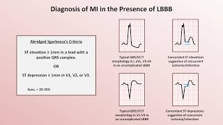 EKGECG Interpretation Basics Nursing NCLEX  QRS Complex P Wave T Wave PR Interval [upl. by Sivra692]