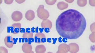 What does a reactive lymphocyte look like [upl. by Hali]