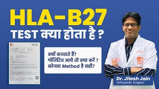 HLAB27 test क्या होता है Back Pain Test  Positive आये तो क्या करें  Dr Jitesh Jain [upl. by Stearn]