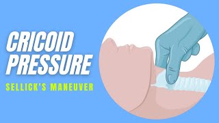 Cricoid pressure  Technique [upl. by Northey]