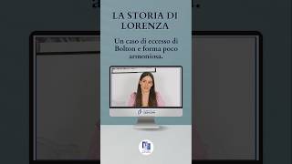 Lorenza ha sempre desiderato un sorriso più armonioso e naturale BellezzaNaturale DentiArmoniosi [upl. by Garlen]