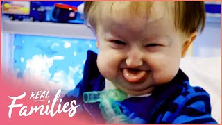 My Baby Has HallermannStreiff Syndrome  Childrens Hospital  Real Families [upl. by Hoy]