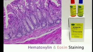 5 Hematoxylin and Eosin staining  HampE MLTLectures [upl. by Htrahddis]