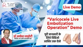 Understanding Varicocele Treatment  Angiography amp Wire Placement in Embolization  Dr Amol Lahoti [upl. by Elbert]