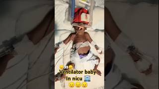 Ventilator baby in Nicu 🏨ytshorts shortvideo viralvideo viralshort trending drnitishsingh [upl. by Anidnamra]