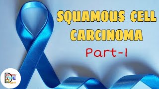 SQUAMOUS CELL CARCINOMA PART1  BENIGN AND MALIGNANT TUMORS OF ORAL CAVITY [upl. by Ahsaya28]