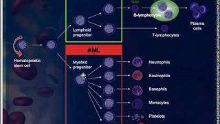 Introduction to Hematological cancers amp Acute Myeloid leukemia [upl. by Ruddy]