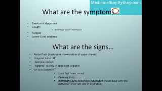 Understanding Mitral Stenosis Signs and Symptoms [upl. by Anilyx]