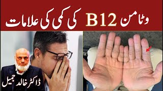 Vitamin B12 Deficiency and Symptoms  Lecture 204 [upl. by Aruabea]