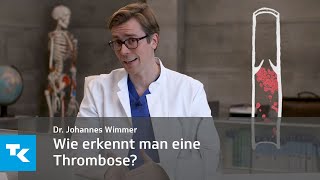 Wie erkennt man eine Thrombose  Dr Johannes Wimmer [upl. by Notlimah481]