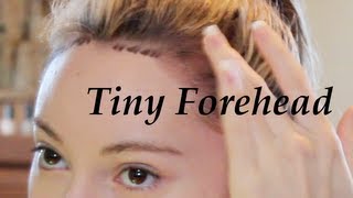 Get a Tiny Forehead Tutorial  Lower Hairline [upl. by Petey]