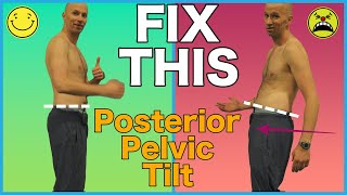 FIX Posterior Pelvic Tilt with 2 Exercises [upl. by Hermione]