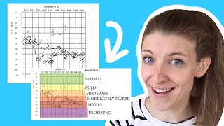 How to Read an Audiogram [upl. by Aviva]