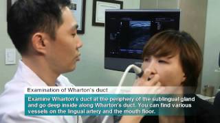 Ultrasound Intra Oral Scanning Procedure [upl. by Natanoj168]