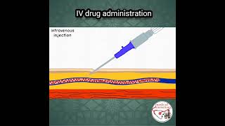 💉 IV DRUG ADMINISTRATION PROCEDURE  ANIMATED EXPLANATION  shorts medicine nurse [upl. by Eatnoj]