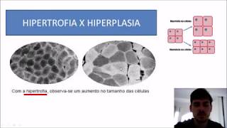 Conceitos de HIPERTROFIA E HIPERPLASIA MUSCULAR [upl. by Syned794]