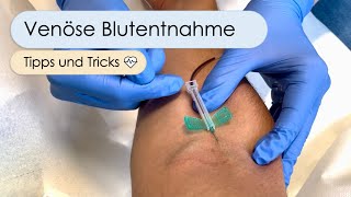 Blutentnahme Mit 19 Tipps amp Tricks zum Erfolg [upl. by Nyre544]