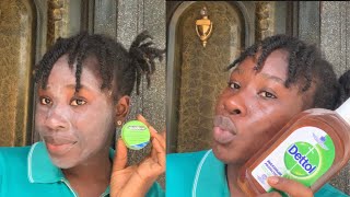 How to use DETTOL antiseptic and NIXODERM to clear your pimples nd dark spots step by step [upl. by Hines618]