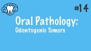 Oral Pathology  Odontogenic Tumors  INBDE ADAT [upl. by Corrine]