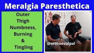 Meralgia Paresthetica Outer thigh numbness burning and tingling [upl. by Pease]