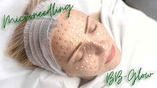 BB Glow and microneedling serums [upl. by Ahsitam]