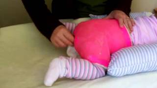 How to change a diaper in a SPICA castSuper easy wthe hipstix order wwwgreatgirldesignsetsycom [upl. by Reema]