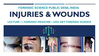 Injuries amp Wounds  Lecture 11 Forensic Medicine  UGC NET Forensic Science [upl. by Nnyled960]