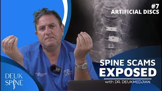 Artificial Disc Replacement Complications Ep7 Spine Scams [upl. by Demetrius934]