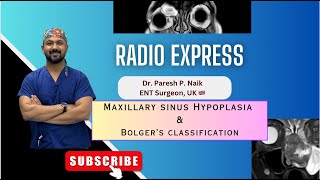 Maxillary sinus hypoplasia amp Bolger Classification [upl. by Xenos]