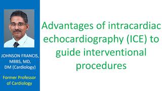 Advantages of intracardiac echocardiography to guide interventional procedures [upl. by Coster743]