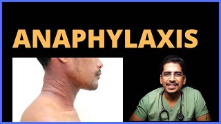 Anaphylaxis signs and symptoms [upl. by Kosey730]