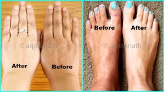 100 EFFECTIVE Hands amp Feet Whitening Remedy  With LIVE Demo [upl. by Icaj]