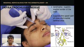 Nerve Blocks on the Face amp Scalp  Supraorbital Greater Occipital Infraorbital Mental etc [upl. by Ylas]