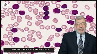 Episode 4 Lymphocytes amp Lymphocytosis [upl. by Aiak]