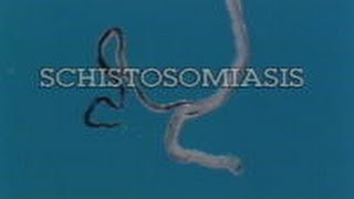 Schistosomiasis Pt 1 of 3 1990 [upl. by Nosraep]