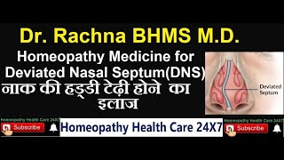 Homeopathy medicine for deviated nasal septum [upl. by Aihsemaj26]