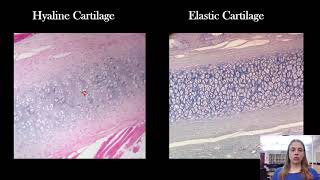 The 4 Most Commonly Confused Tissue Types [upl. by Innes]